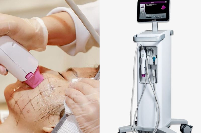 Thermi Skin Tightening Costa Rica